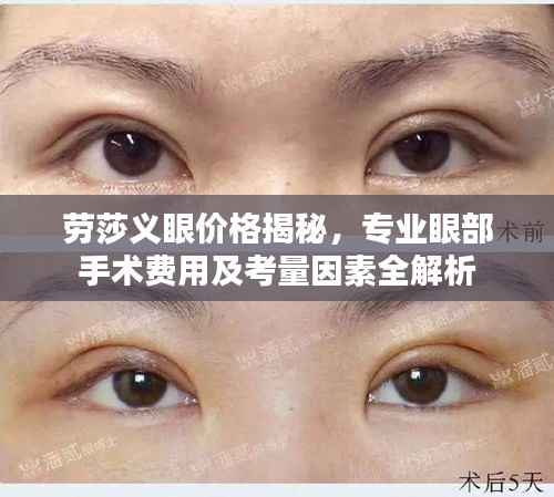 劳莎义眼价格揭秘,专业眼部手术费用及考量因素全解析